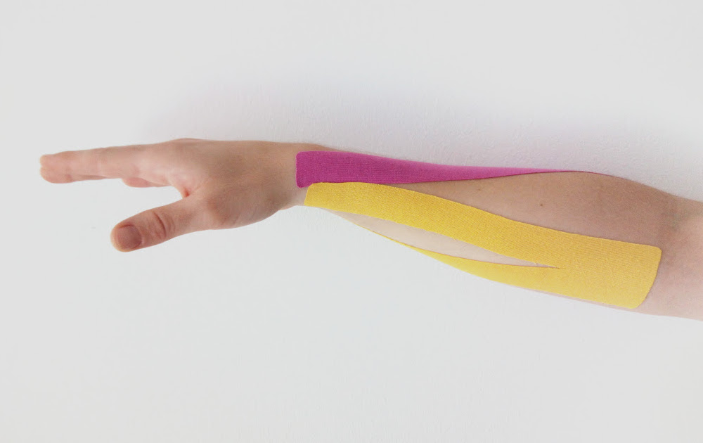 Kinesiotape antebrazo